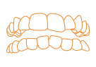 treatablecase crowdedteeth