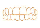  treatablecase underbite